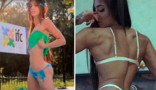 antes y después de Bakhar Nabieva